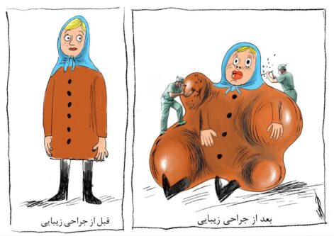 نگاهی جامعهشناختی به رواج انواع پروتزهای بهاصطلاح زیبایی!