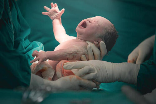 مزایای زایمان طبیعی برای مادر و نوزاد