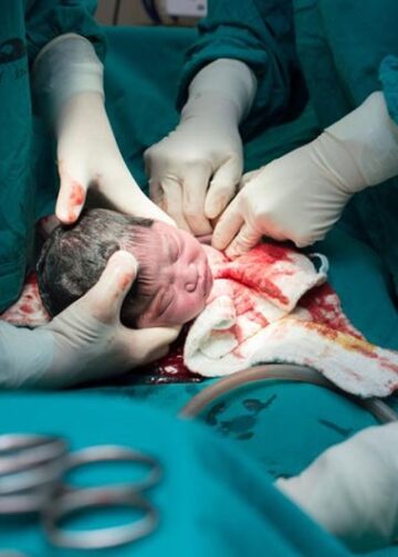 وقتی عمل سزارین مد می‌شود