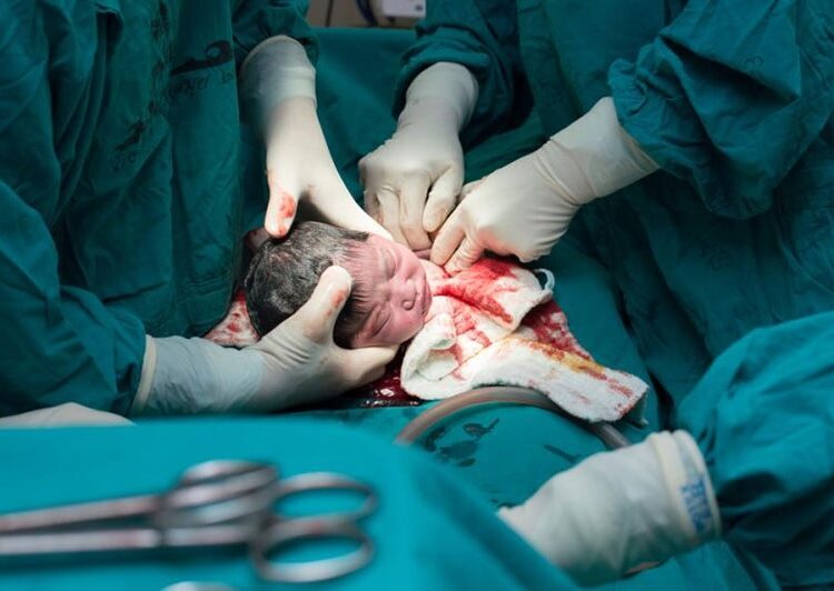 وقتی عمل سزارین مد می‌شود