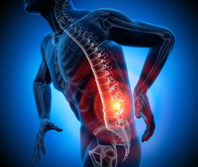 «سیاتیک» چگونه درمان می‌شود؟